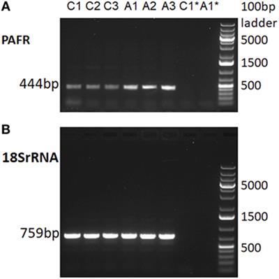 A Possible Role for Platelet-Activating Factor Receptor in Amyotrophic Lateral Sclerosis Treatment